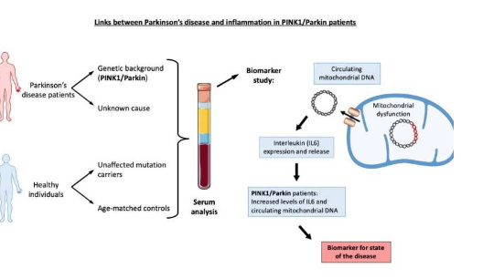 新研究強調(diào)炎癥與帕金森氏病之間的聯(lián)系