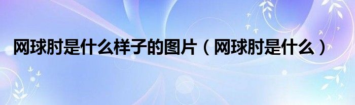 網(wǎng)球肘是什么樣子的圖片（網(wǎng)球肘是什么）