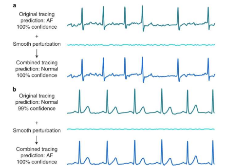 發(fā)現(xiàn)深度學(xué)習(xí)心電圖設(shè)備容易受到對(duì)抗性攻擊