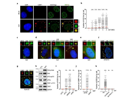 新研究揭示肺細(xì)胞如何保護(hù)自己免受 RNA 病毒感染