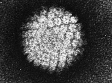 研究發(fā)現(xiàn)人們對(duì) HPV 與宮頸癌之間聯(lián)系的認(rèn)識(shí)有所下降