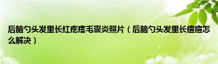 后腦勺頭發(fā)里長(zhǎng)紅疙瘩毛囊炎照片（后腦勺頭發(fā)里長(zhǎng)痘痘怎么解決）