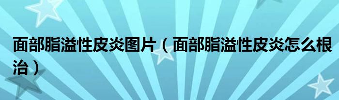 面部脂溢性皮炎圖片（面部脂溢性皮炎怎么根治）