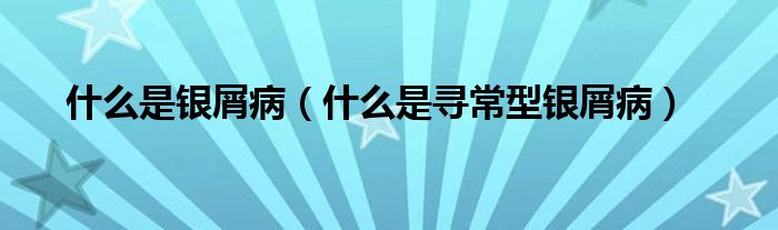 什么是銀屑病（什么是尋常型銀屑?。?class='thumb lazy' /></a>
		    <header>
		<h2><a  href=