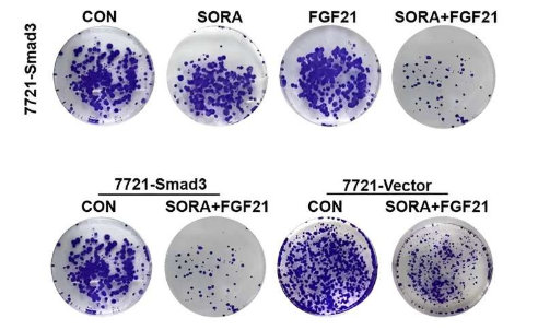 研究表明 SORA 和 FGF21 聯(lián)合治療肝細(xì)胞癌的可能性