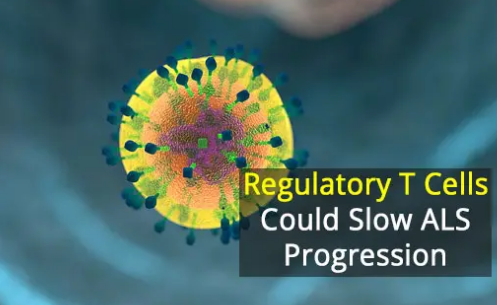 最新研究表明新的免疫療法對ALS患者是安全的